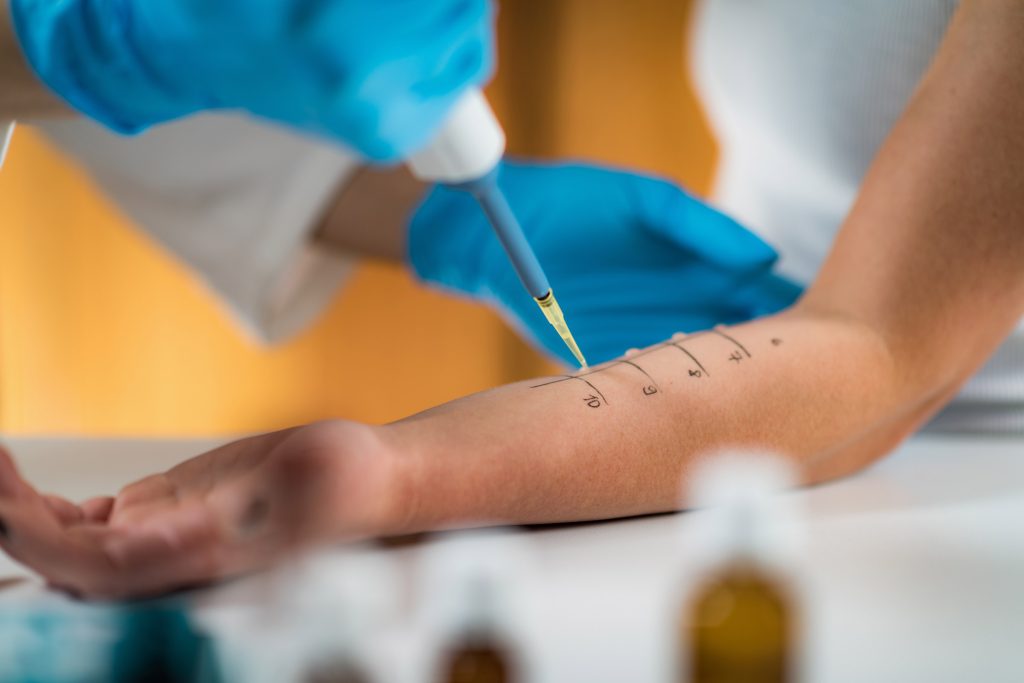 visita allergologica in cosa consiste